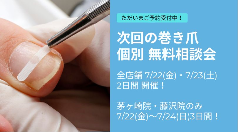 茅ヶ崎市　巻き爪　無料相談会