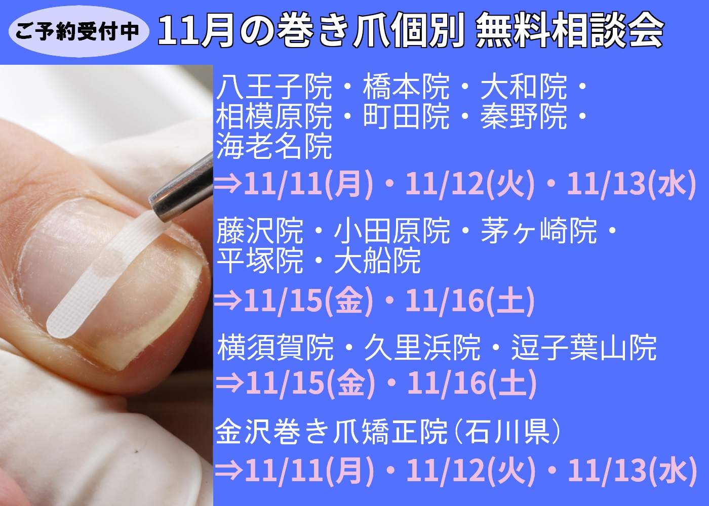 茅ヶ崎市　巻き爪　無料相談会