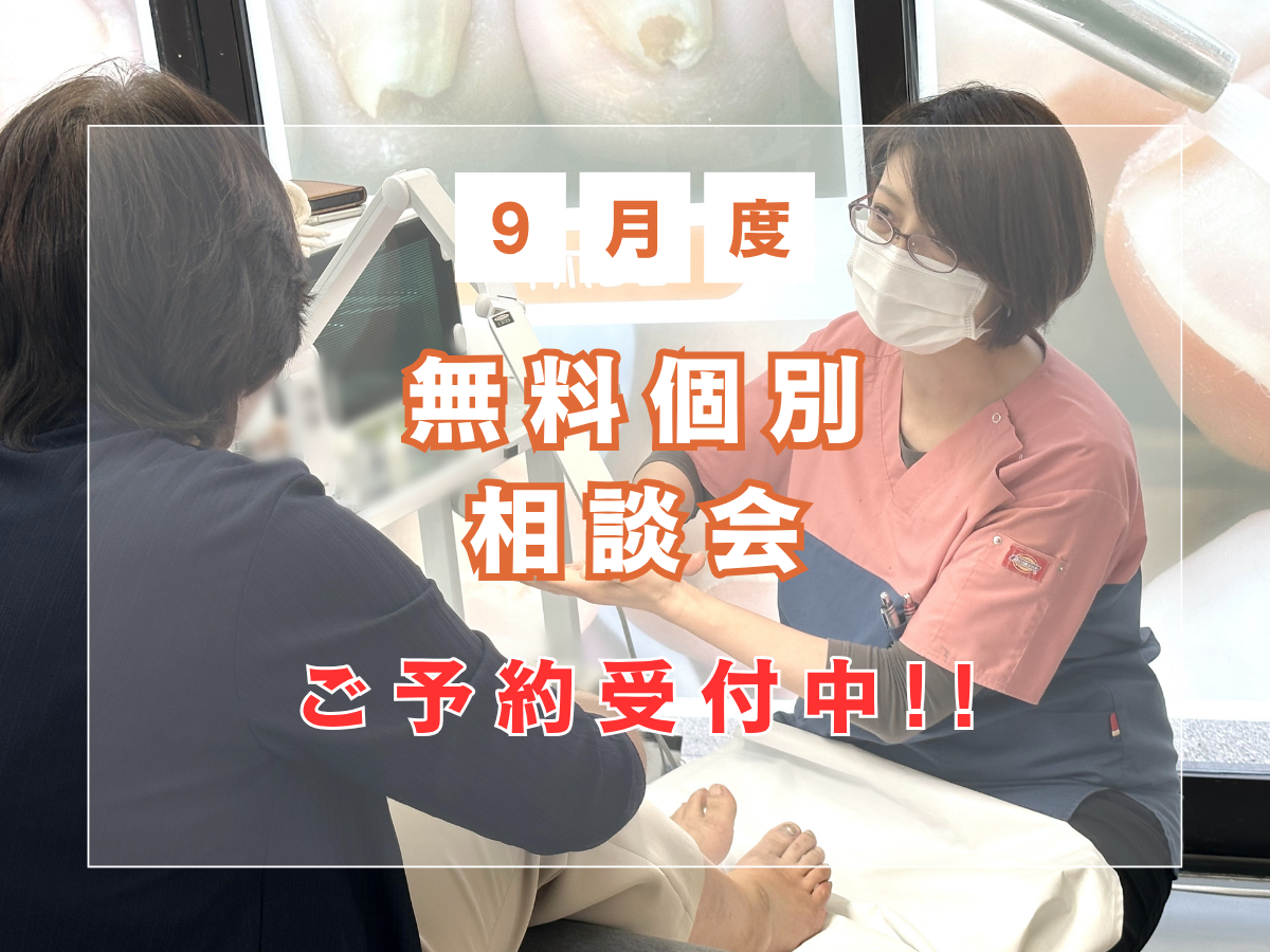 相模原市橋本　巻き爪　無料相談会