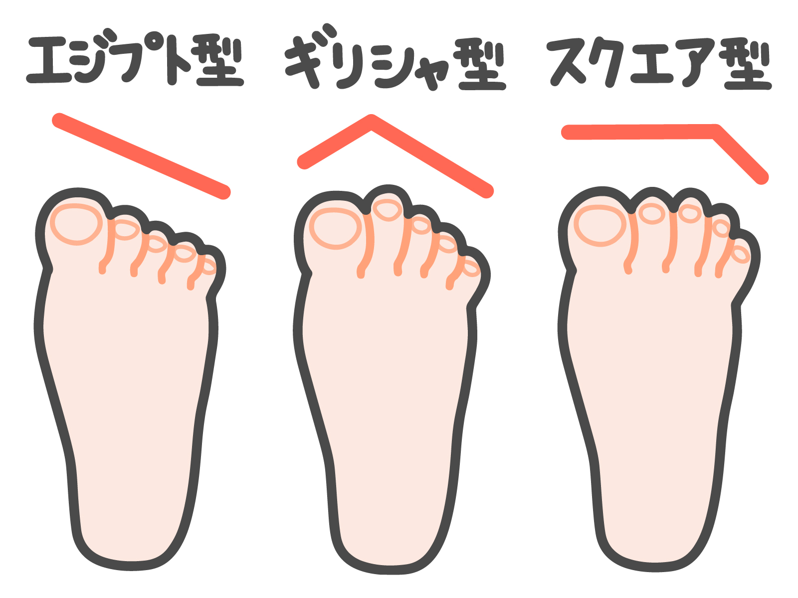 平塚市　巻き爪　足の形