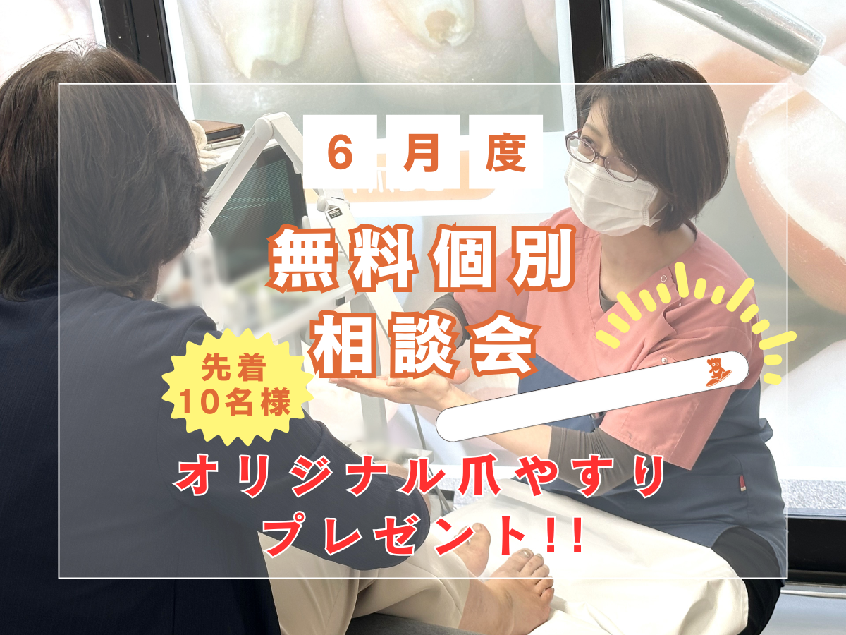 平塚市　巻き爪　無料相談会