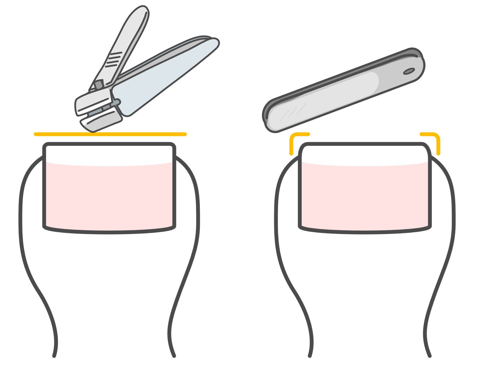 町田市 巻き爪 爪切り
