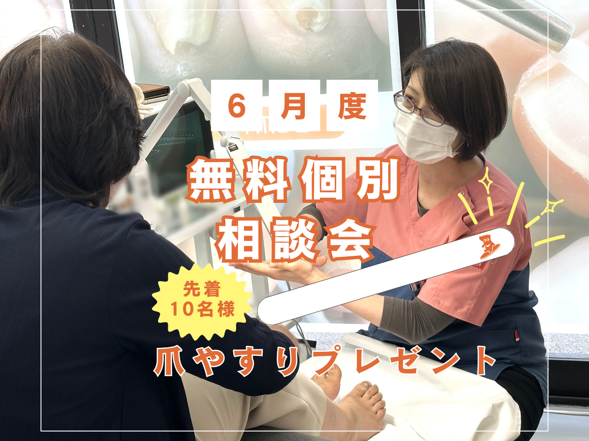 大船　巻き爪　無料相談会