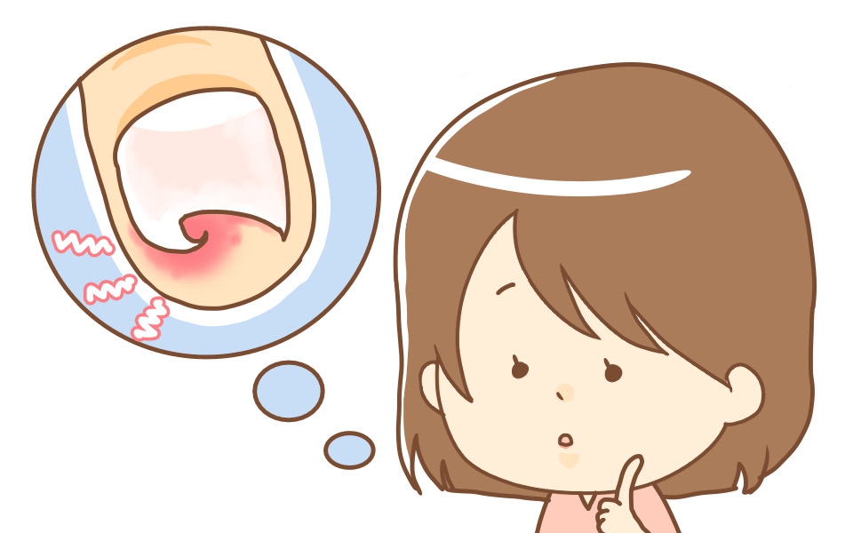 大船　巻き爪　女性