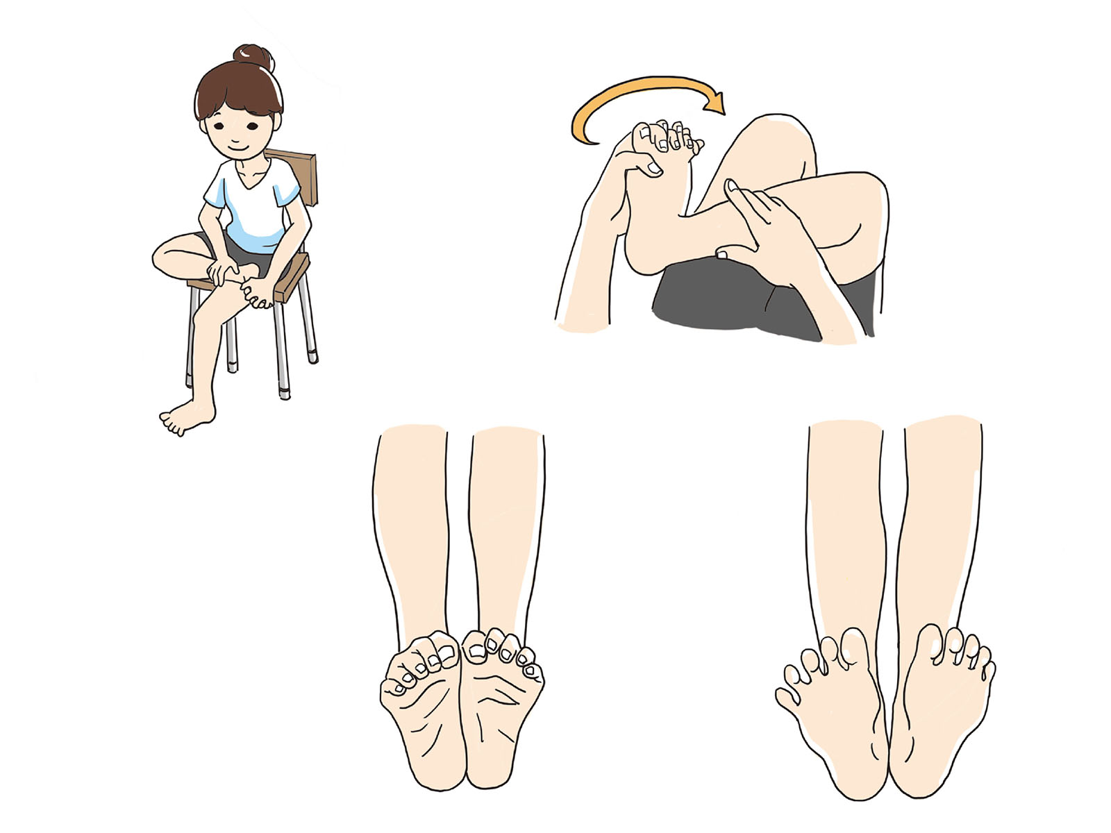 大船 巻き爪 女性