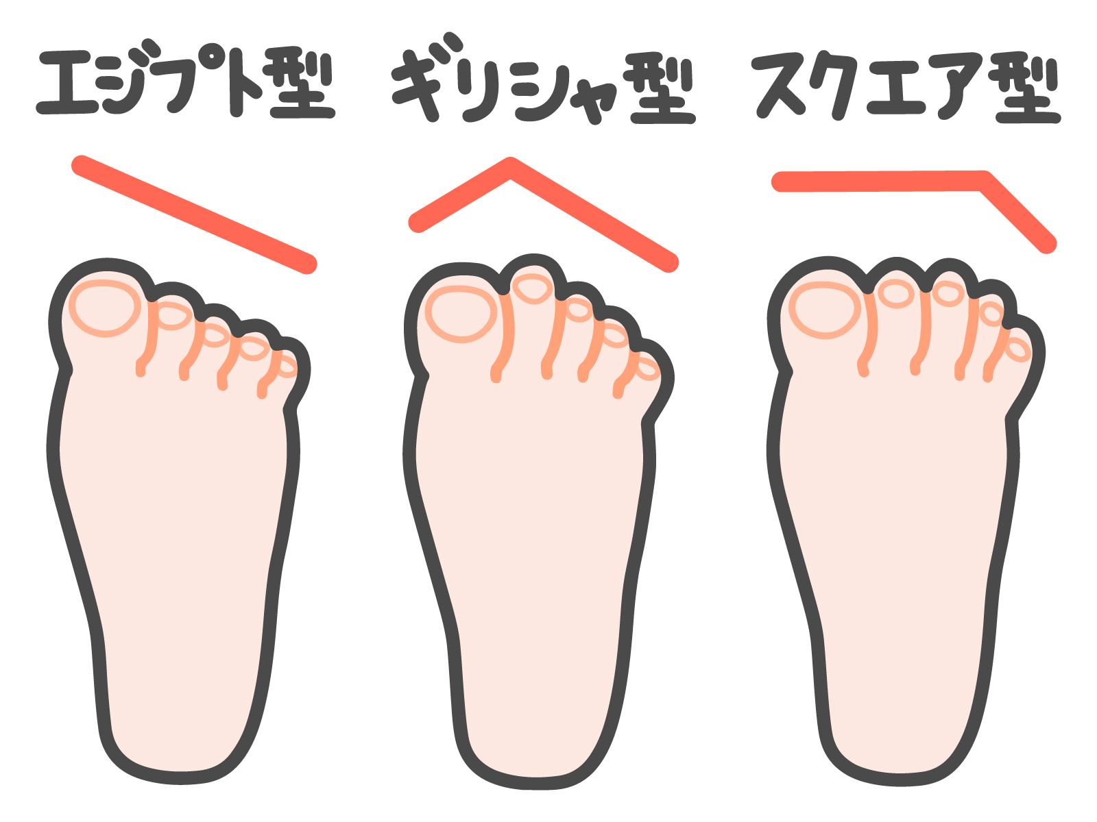 相模大野　巻き爪　足の形