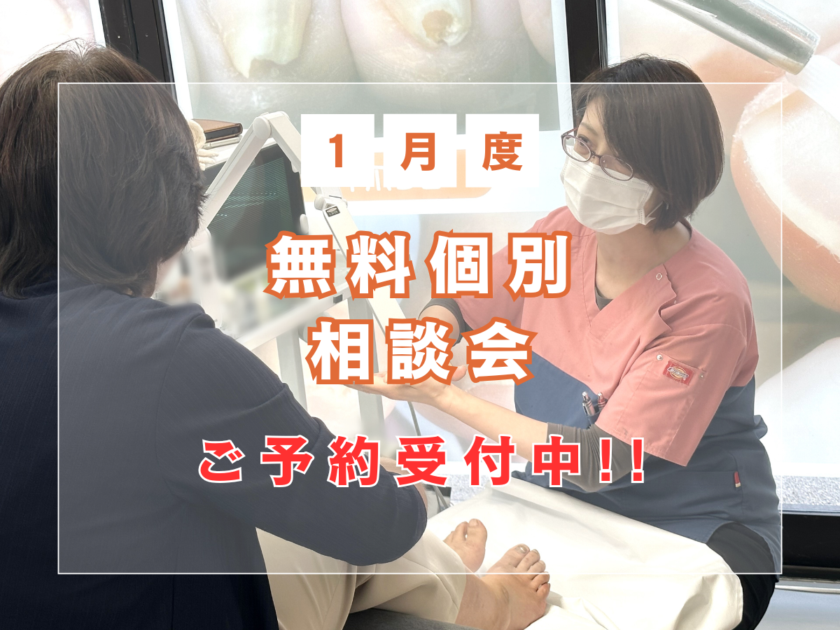 大和市　巻き爪　無料相談会