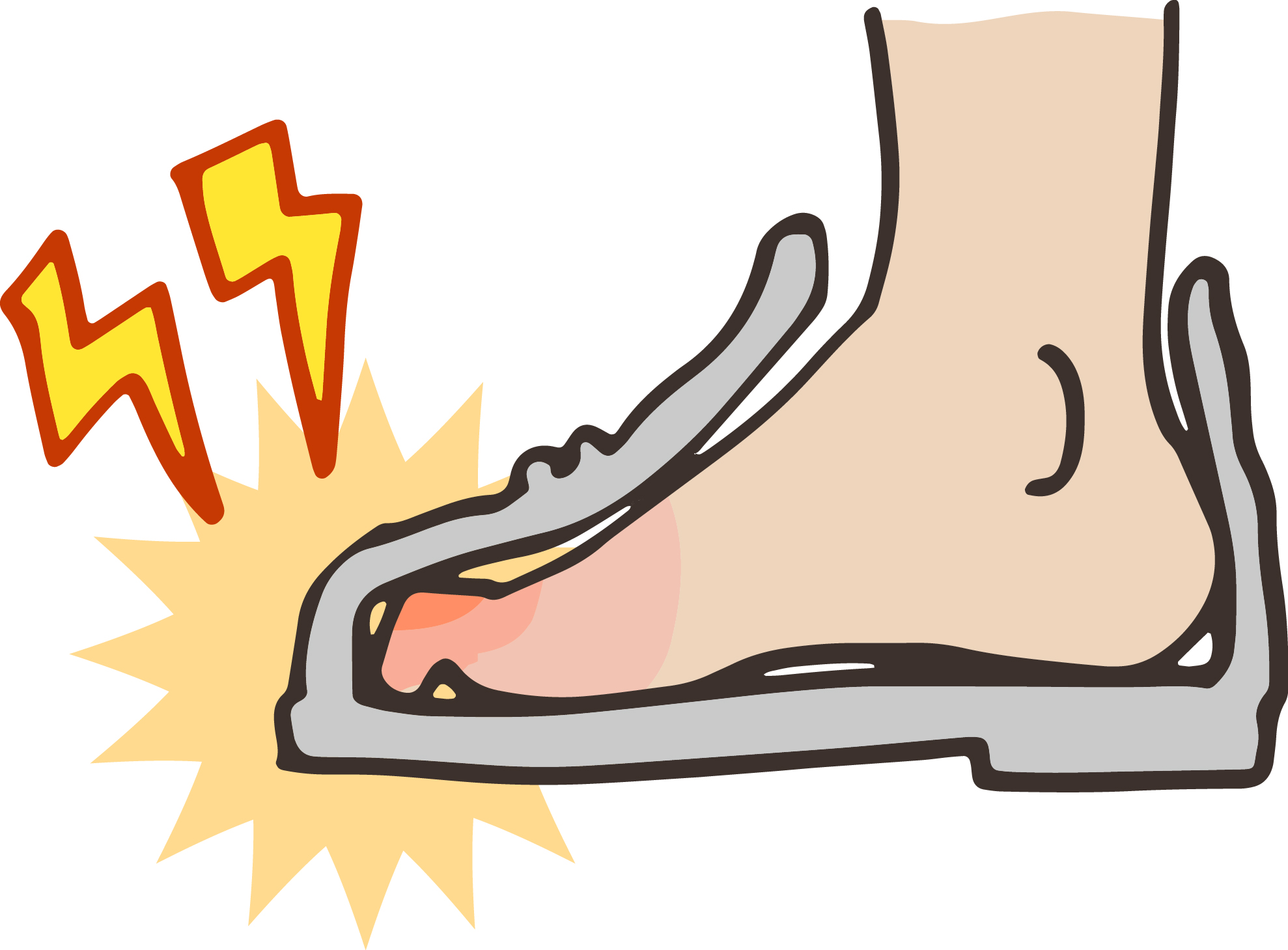 大和市　巻き爪　靴