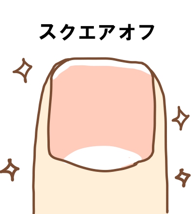 横須賀市　巻き爪　爪の形