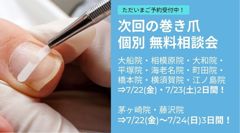 海老名市　巻き爪　無料相談会