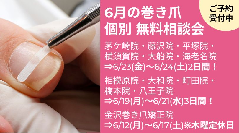 海老名市　巻き爪　無料相談会