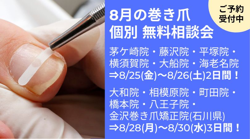 海老名市　巻き爪　無料相談会