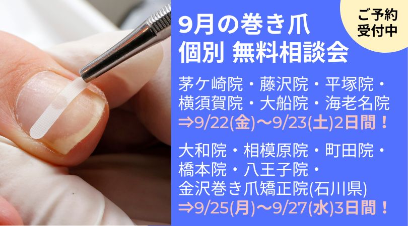 海老名市　巻き爪　無料相談会