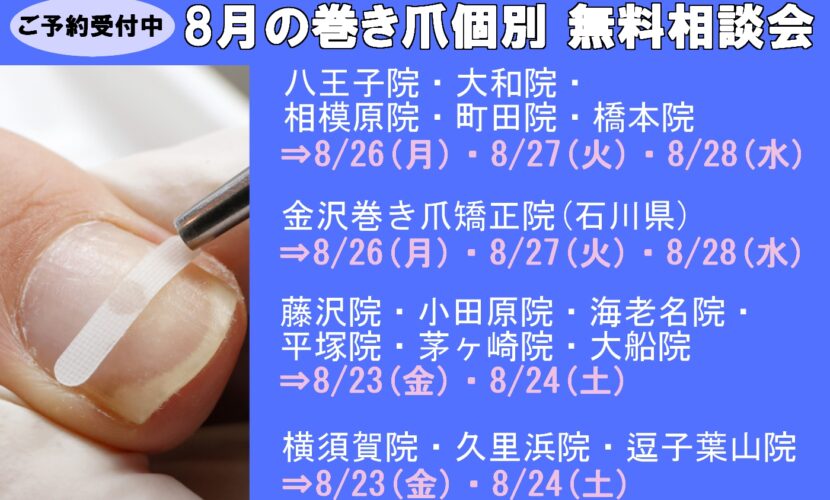 海老名市　巻き爪　無料相談会