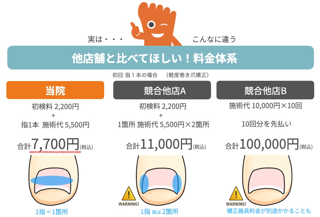 海老名市　巻き爪　料金体系