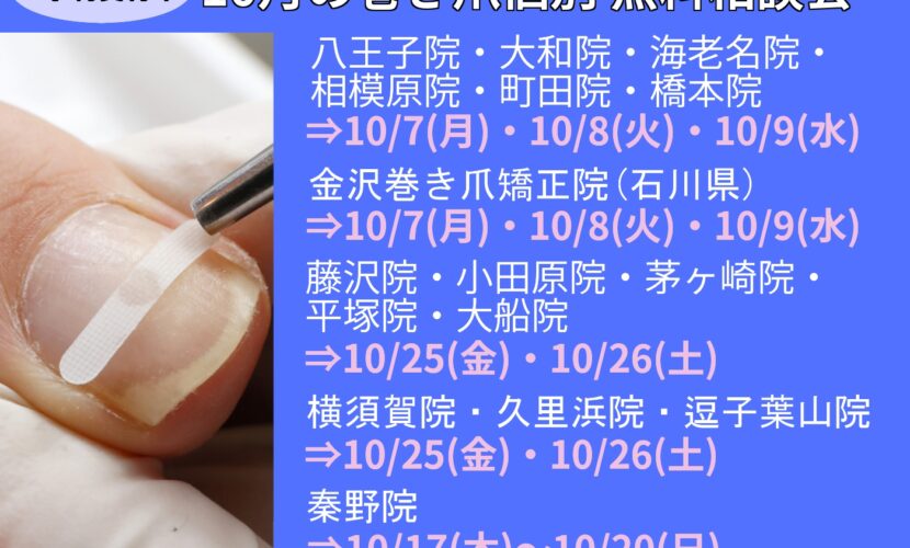 海老名市　巻き爪　無料相談会