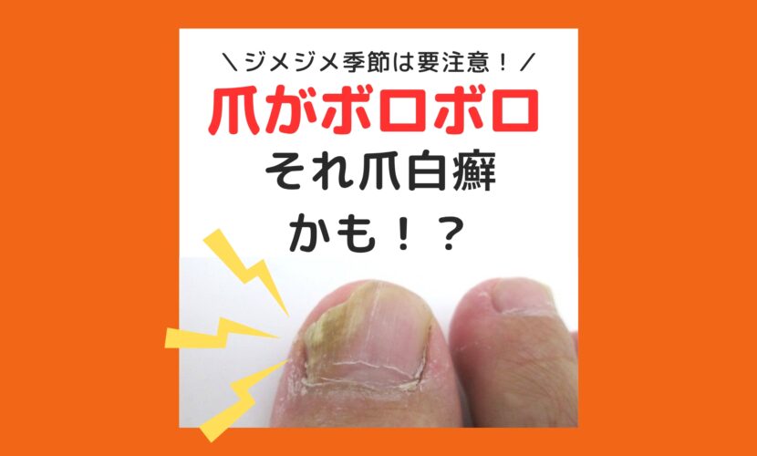 海老名市　巻き爪　爪白癬