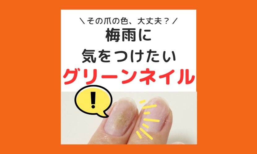 海老名市　巻き爪　グリーネイル