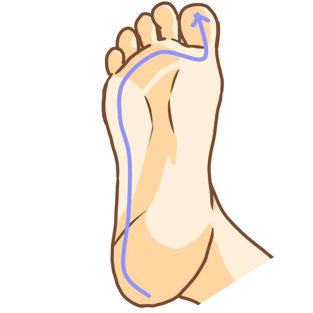 海老名市 巻き爪 足