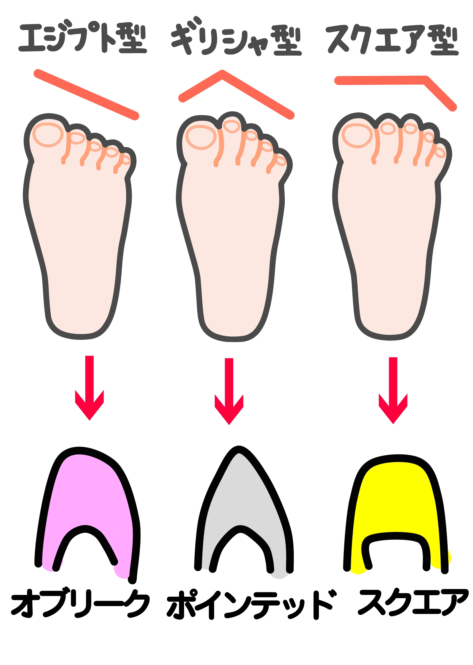 藤沢市　巻き爪　靴