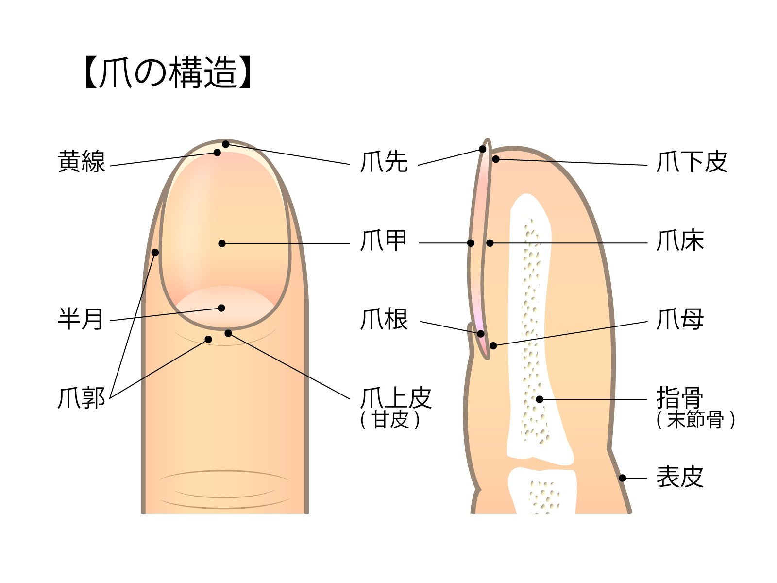 秦野市　巻き爪　爪