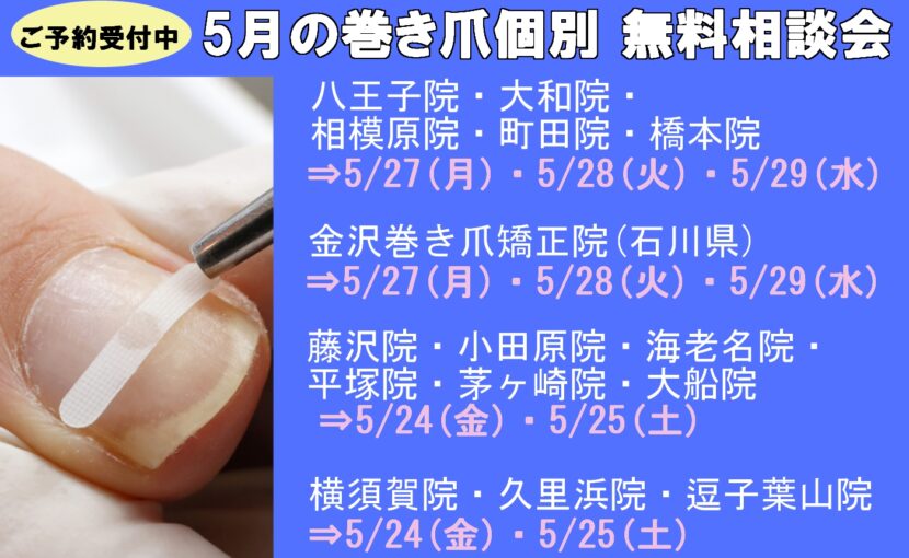 相模原市橋本　巻き爪　無料相談会