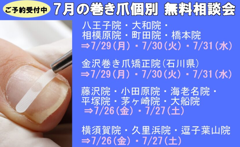 相模原市橋本　巻き爪　無料相談会