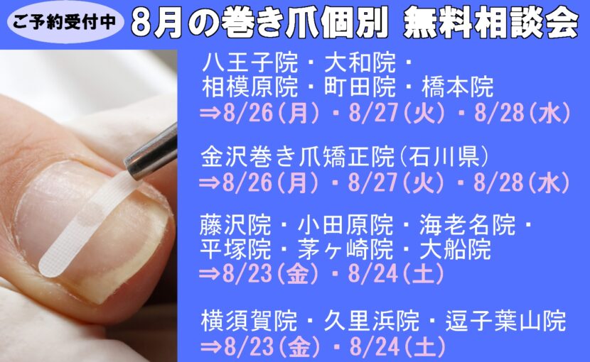 相模原市橋本　巻き爪　無料相談会