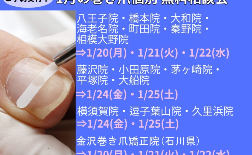 相模原市橋本　巻き爪　無料相談会