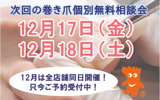 平塚市　巻き爪　無料相談会