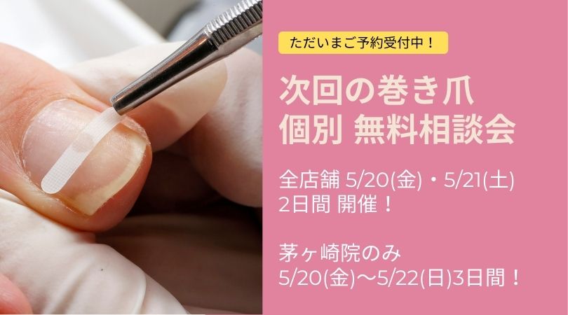 平塚市　巻き爪　無料相談会