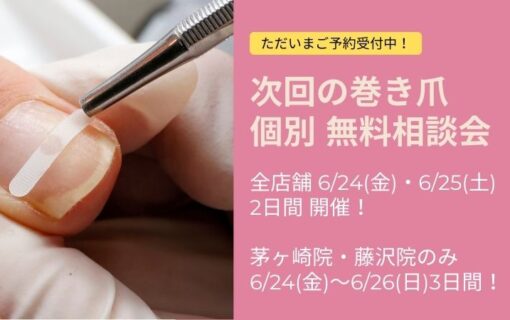 平塚市　巻き爪　無料相談会