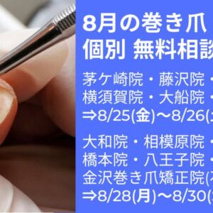 平塚市　巻き爪　無料相談会