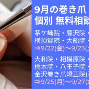 平塚市　巻き爪　無料相談会