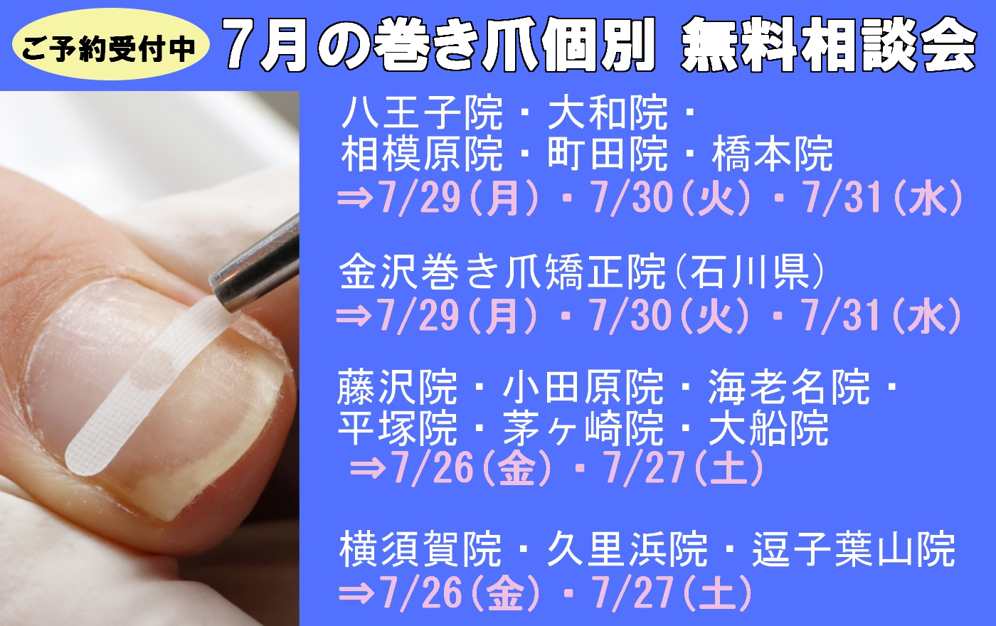 平塚市　巻き爪　無料相談会