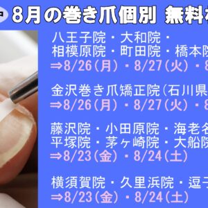 平塚市　巻き爪　無料相談会