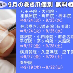 平塚市　巻き爪　無料相談会