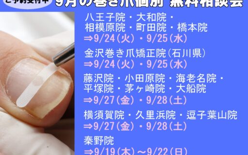 平塚市　巻き爪　無料相談会