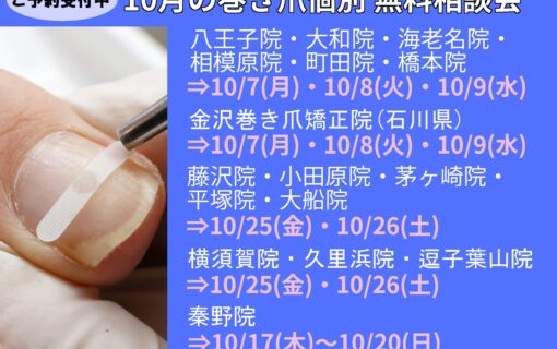 平塚市　巻き爪　無料相談会