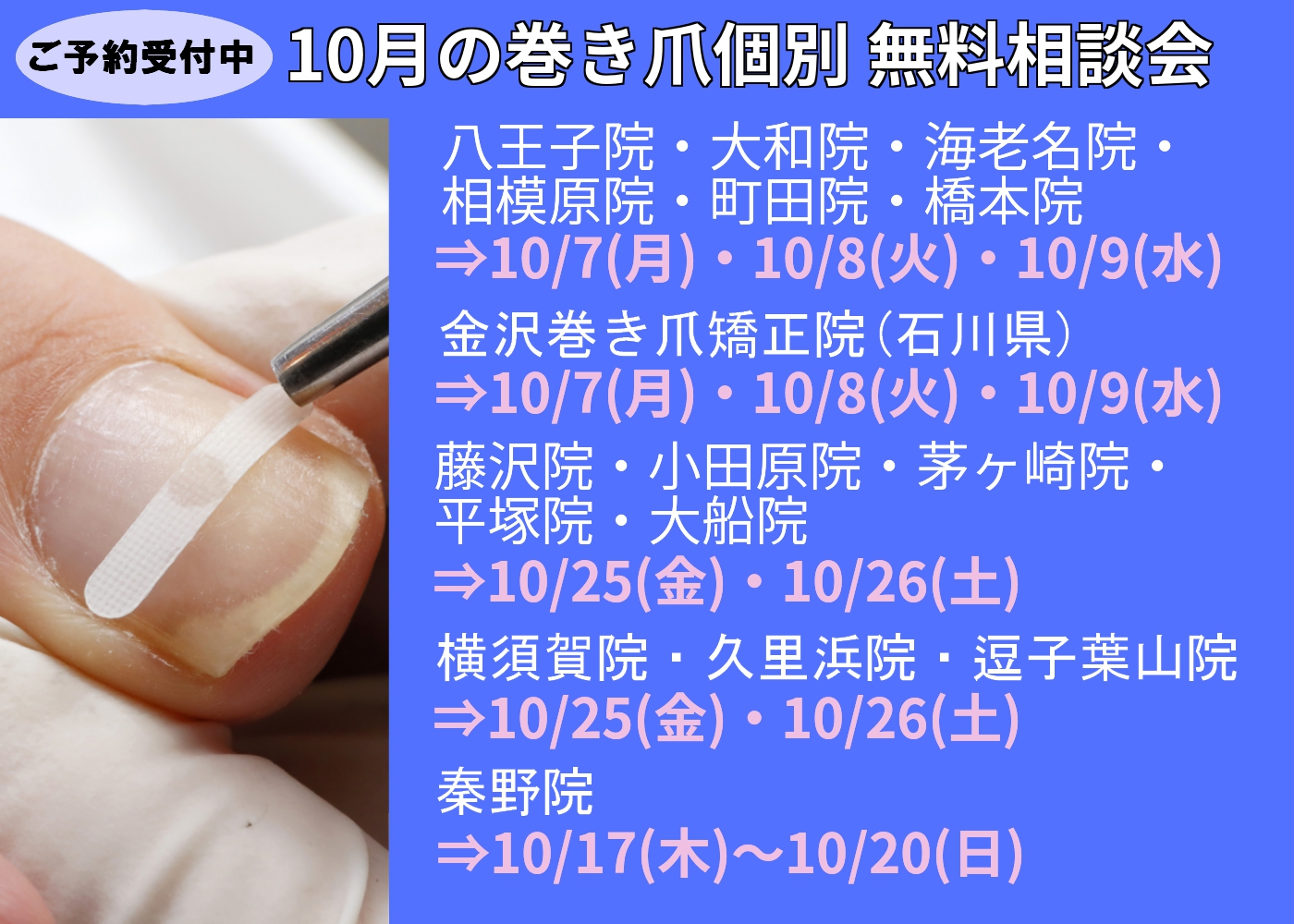 平塚市　巻き爪　無料相談会