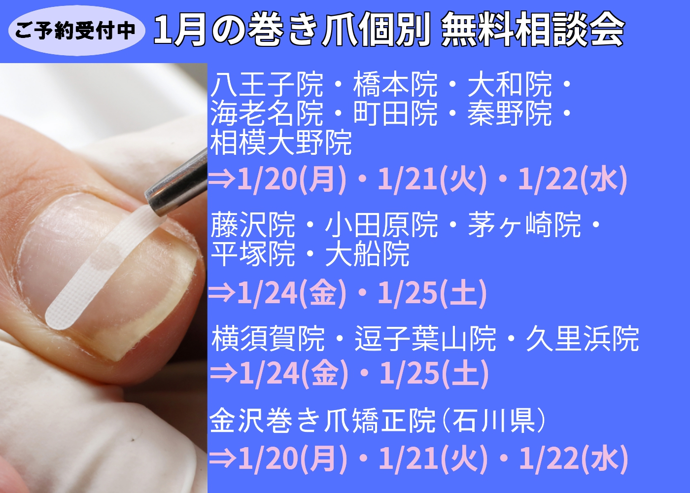 平塚市　巻き爪　無料相談会