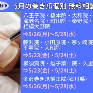 平塚市　巻き爪　無料相談会