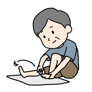 平塚市　巻き爪　爪切り