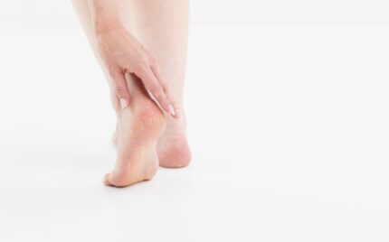 平塚市　巻き爪　足