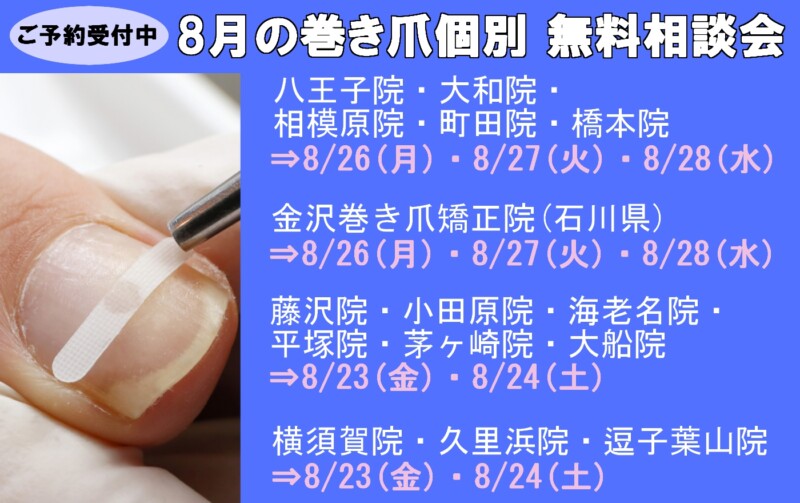 横須賀市久里浜　巻き爪　無料相談会