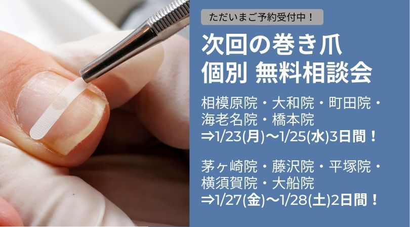 町田市　巻き爪　無料相談会