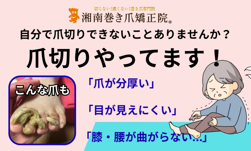 町田市　巻き爪　爪切り
