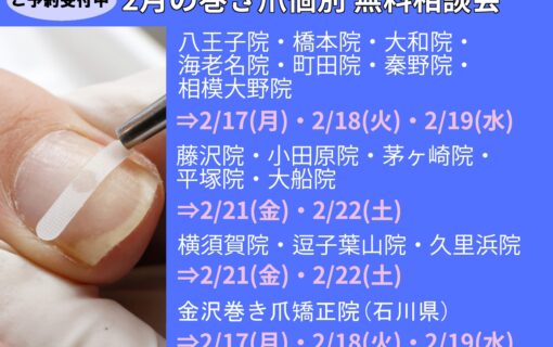 大船　巻き爪　無料相談会