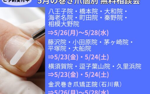 大船　巻き爪　無料相談会