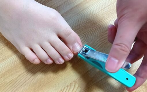 大船　巻き爪　爪切り